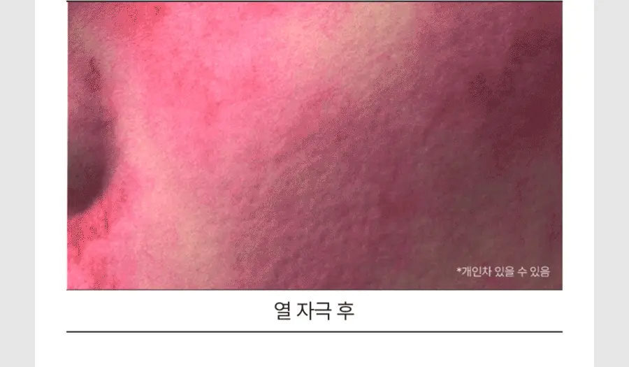 [NEW/쿨링진정] 닥터지 레드 블레미쉬 쿨 수딩 젤리 미스트 50ml 상세페이지 26